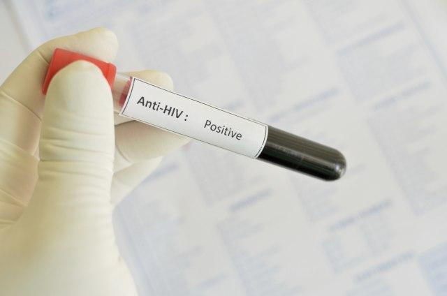 Naučnici prvi put izlečili miševe od HIV-a